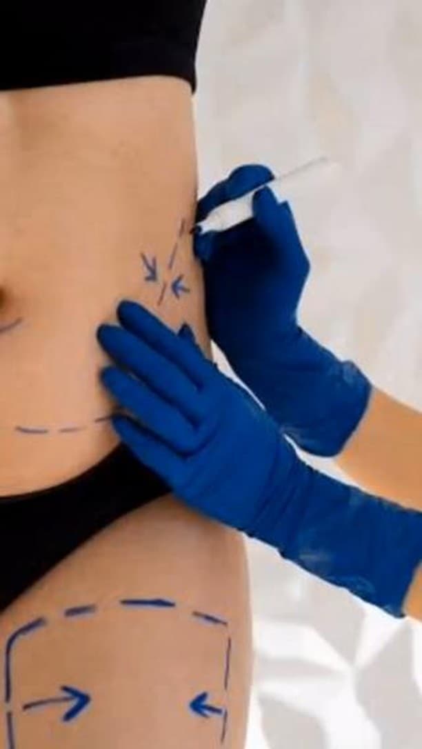 ✨ Pre-operatory Tips from Dr. Karlinsky ✨

Getting ready for surgery? 📝 Dr. Karlinsky shares essent