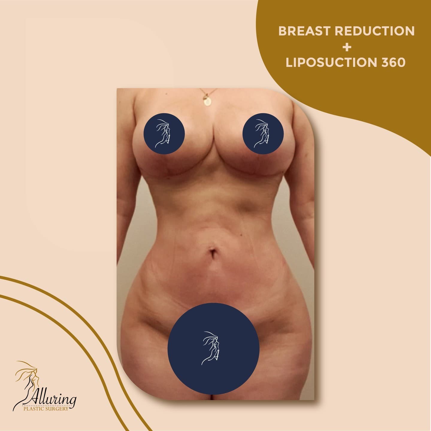 Instagram carousel item from alluringplasticsurgery