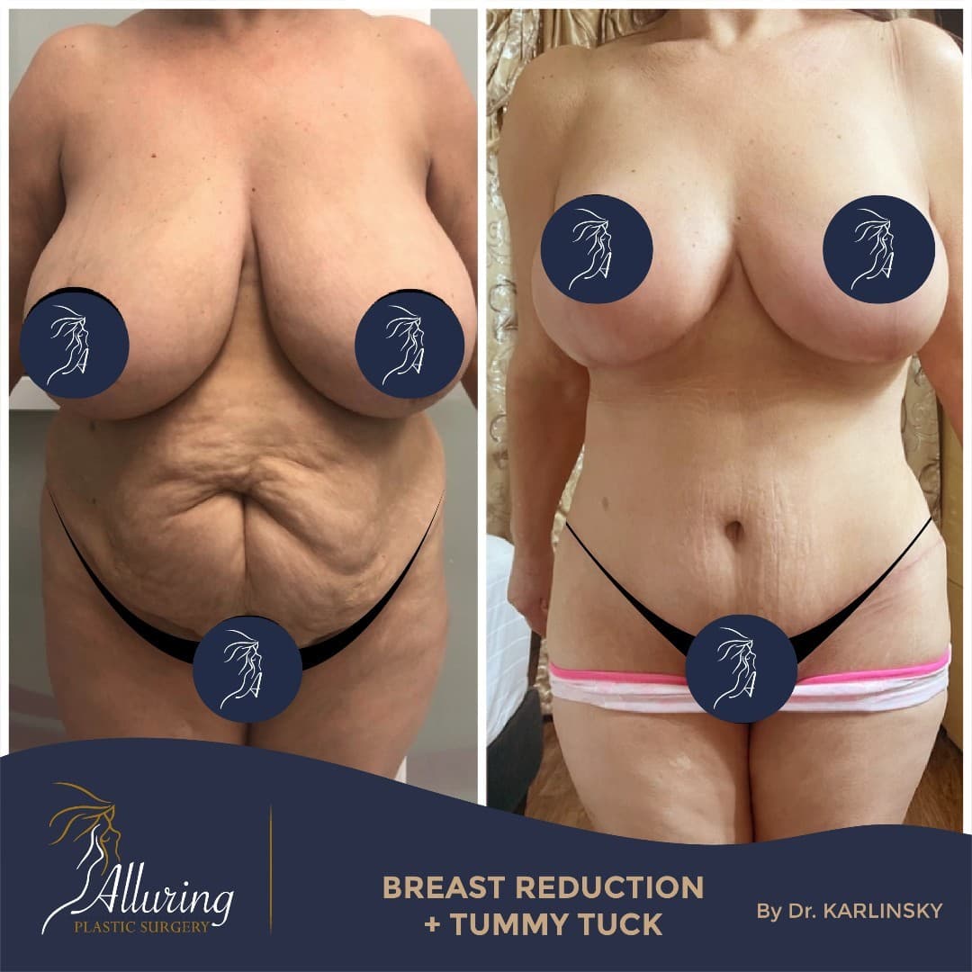 Instagram post from alluringplasticsurgery