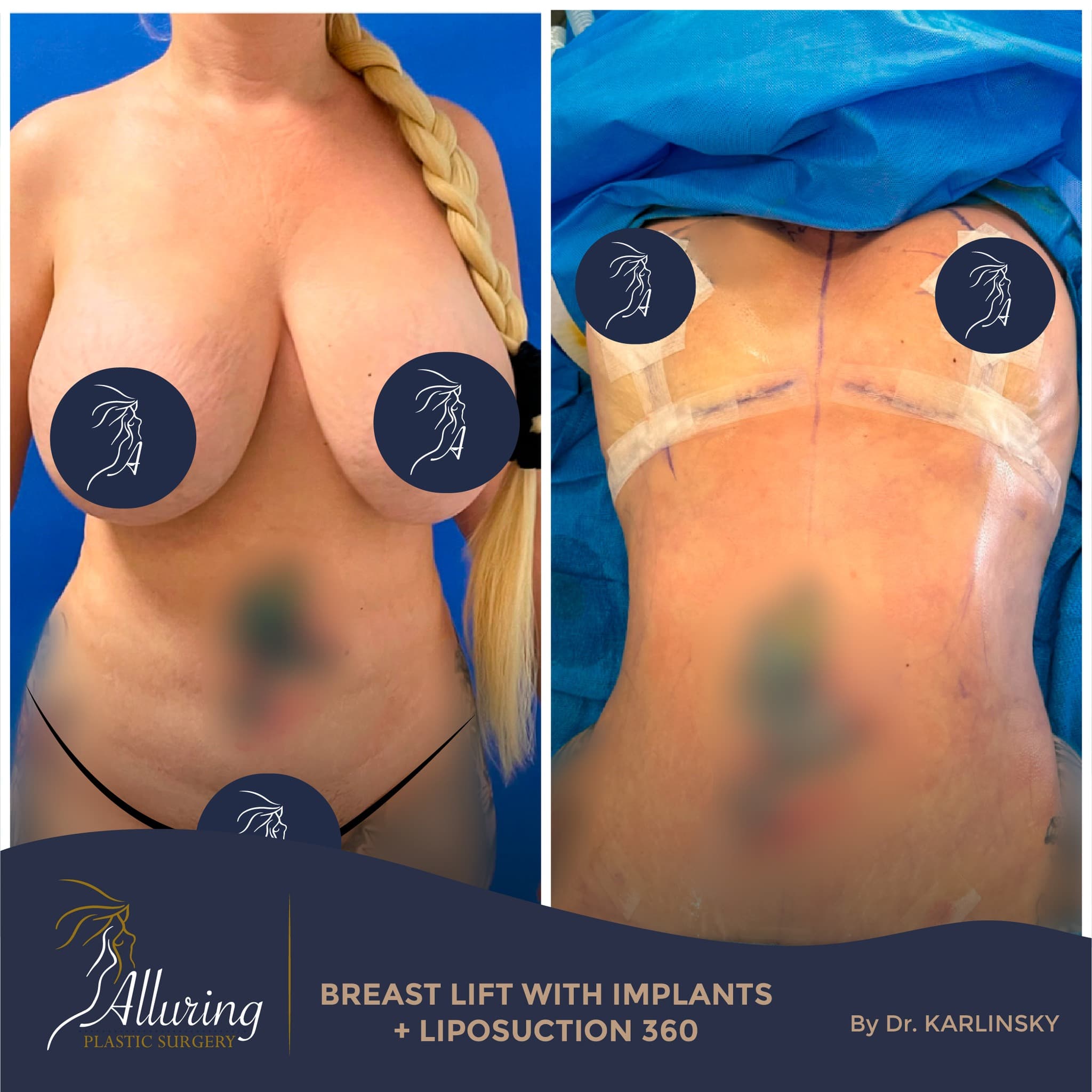 Instagram post from alluringplasticsurgery