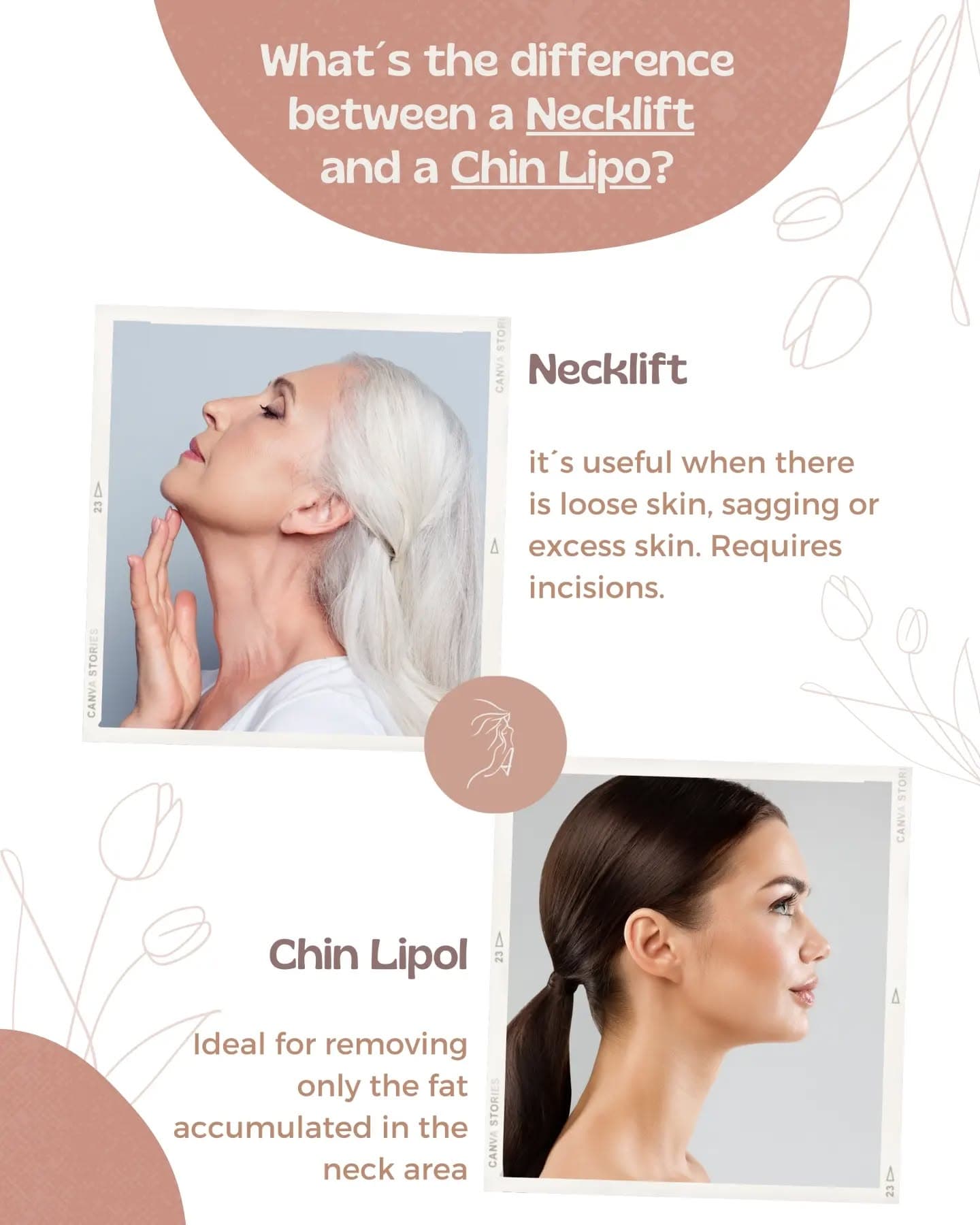 💡 Neck Lift or Chin Lipo?✨

Not sure which one is right for you? Check out the image to see the key