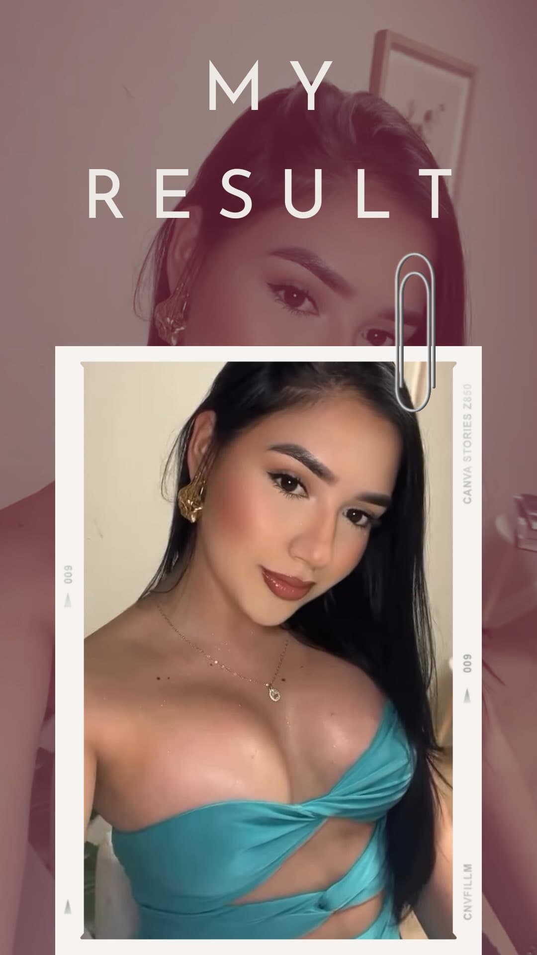 The best investment will always be yourself 💖😏😻

She had a breast augmentation and while the resu