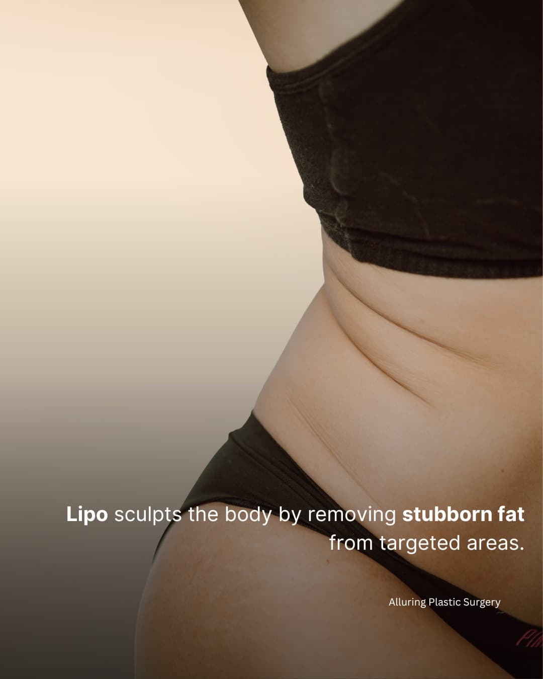 Lipo isn’t just about removing fat — it’s about reshaping your body to highlight your natural curves