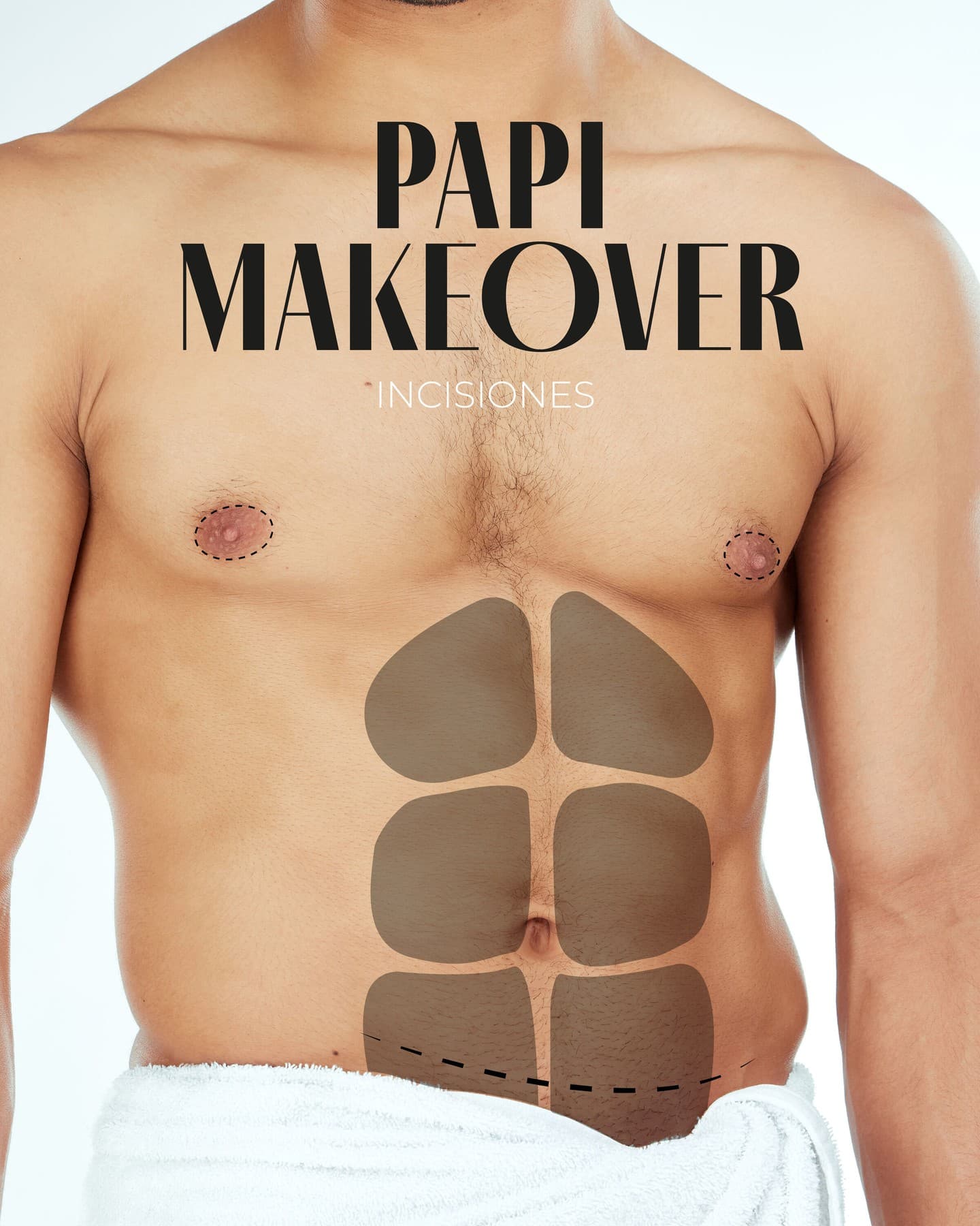 🔍 Conociendo las incisiones de un Papi Makeover 🔍

Cuando se trata de un Papi Makeover (tummy tuck