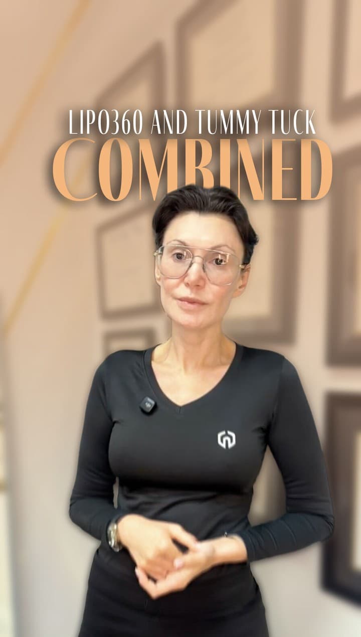 Dr. K explains that liposuction and tummy tuck can be combined—but it depends on your unique body an