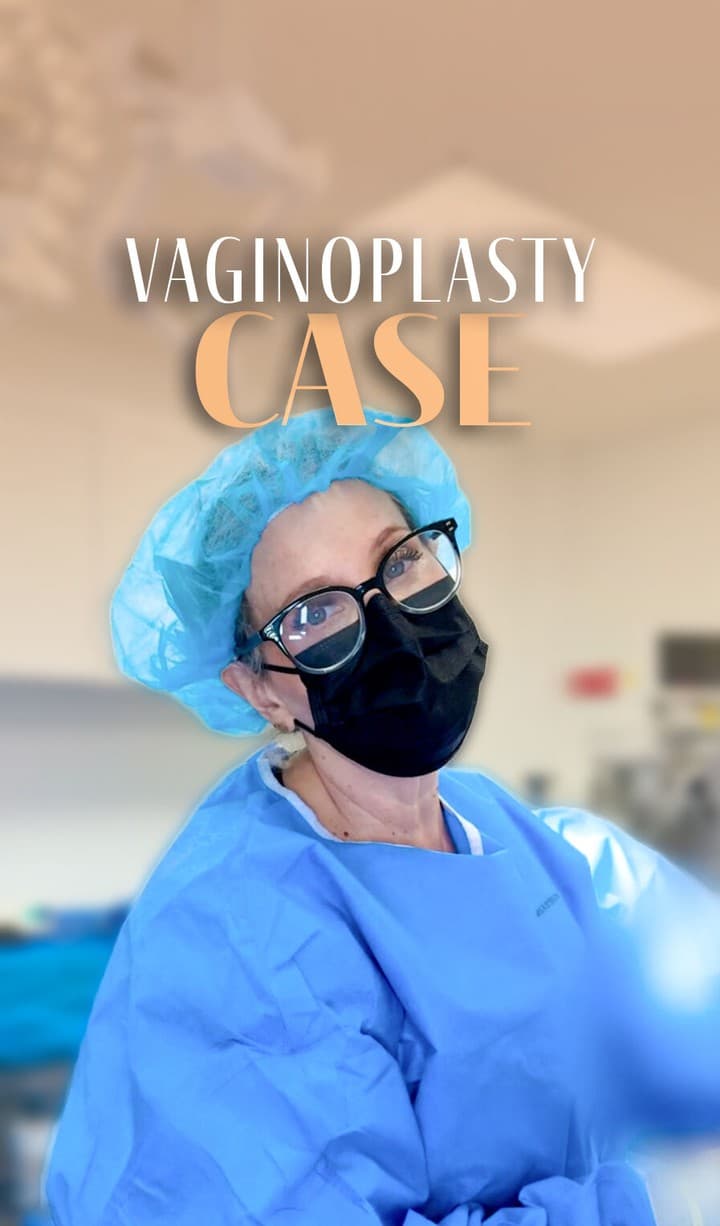 Dr. Shats is performing a vaginoplasty + perineoplasty on a patient who experienced 2 vaginal delive