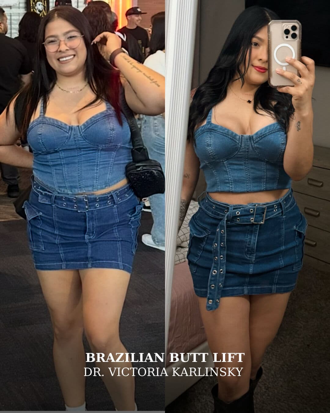 She got the shape, the curve, the confidence 🔥

BBL results that turn heads and boost self-love — o