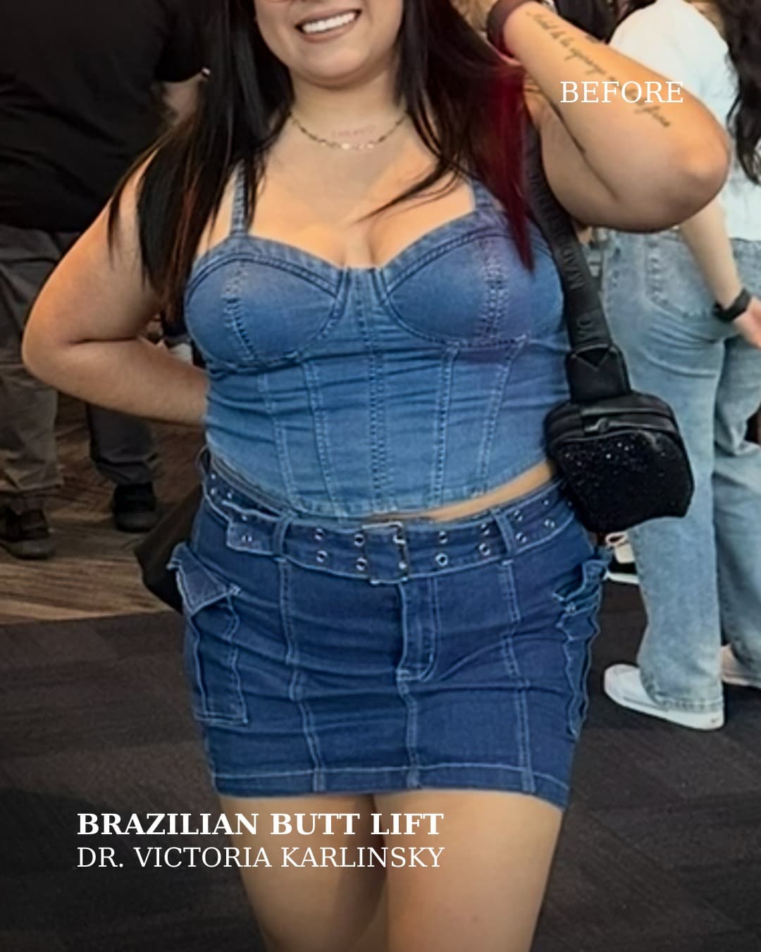 Instagram carousel item from alluringplasticsurgery