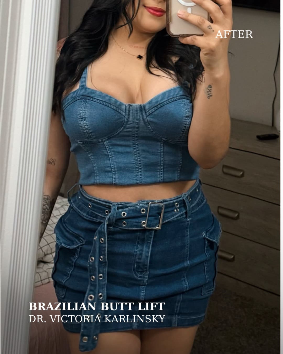 Instagram carousel item from alluringplasticsurgery