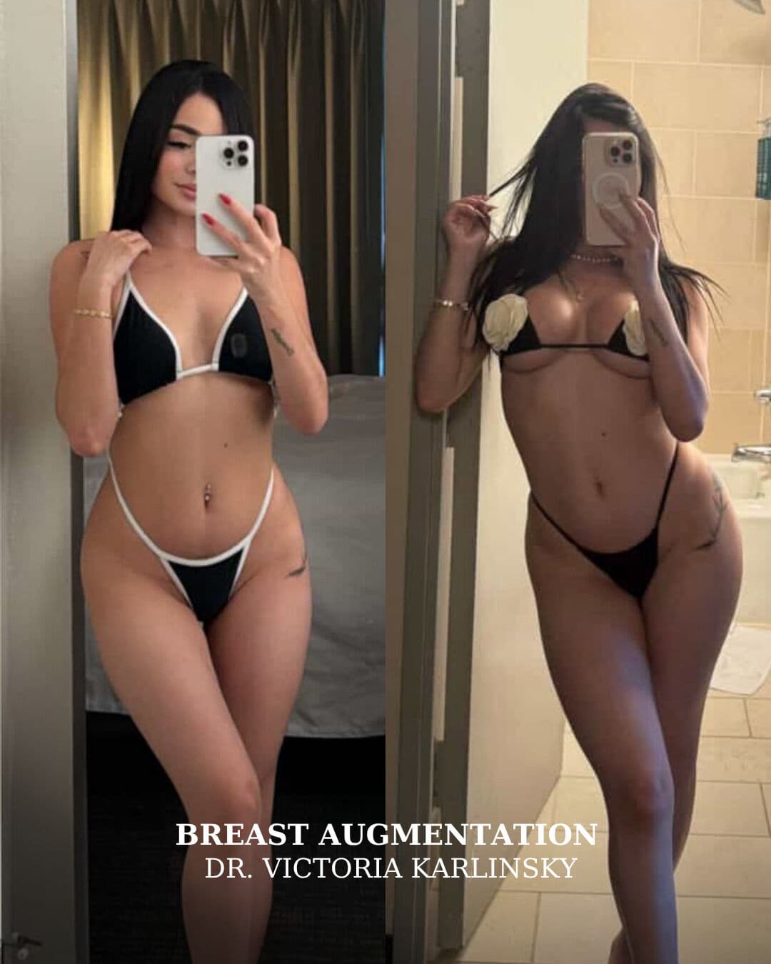 Instagram post from alluringplasticsurgery