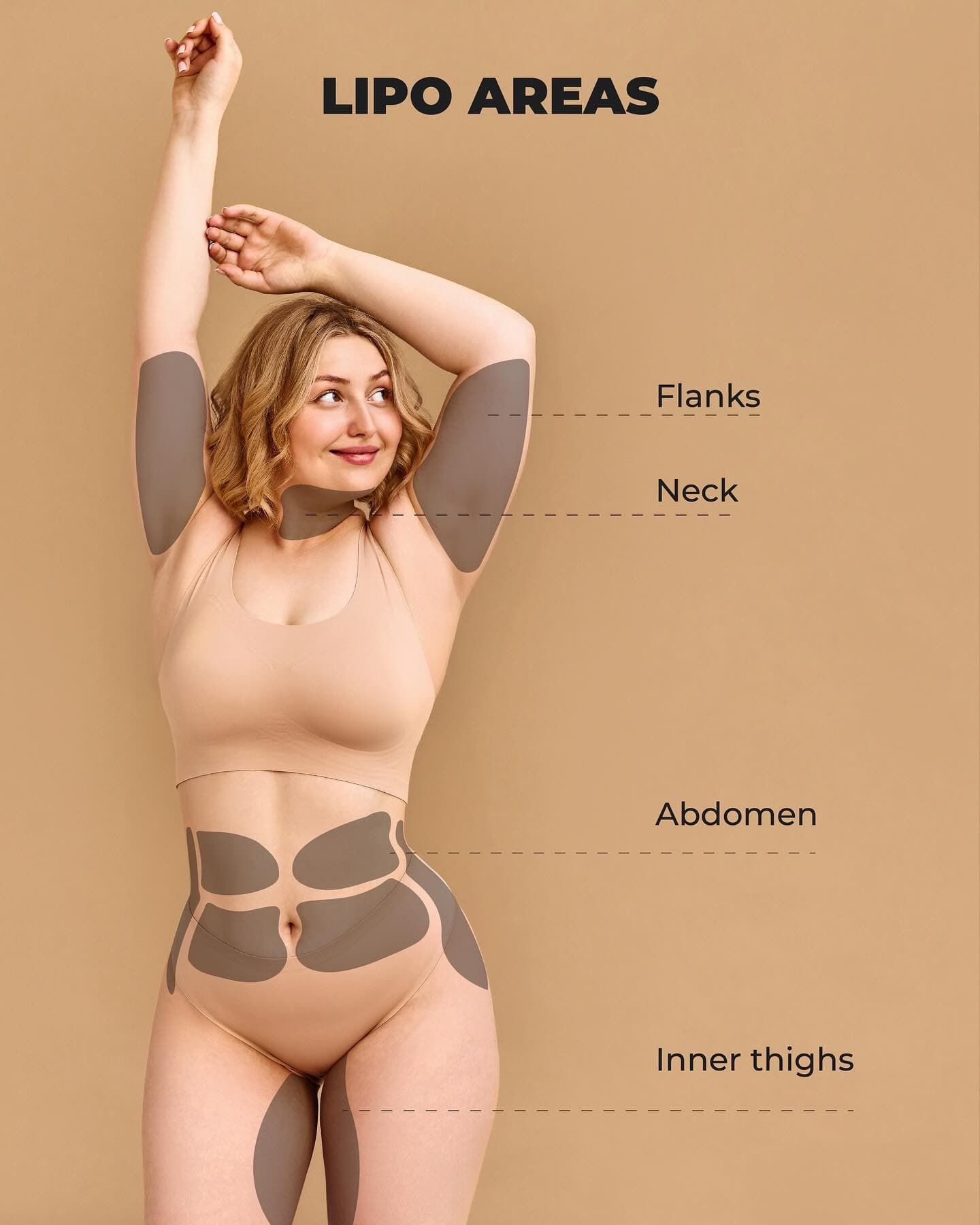 Educational illustration of a woman with shaded regions highlighting common liposuction target areas on the upper arms, neck, flanks, abdomen, and inner thighs, labeled and outlined for clarity.