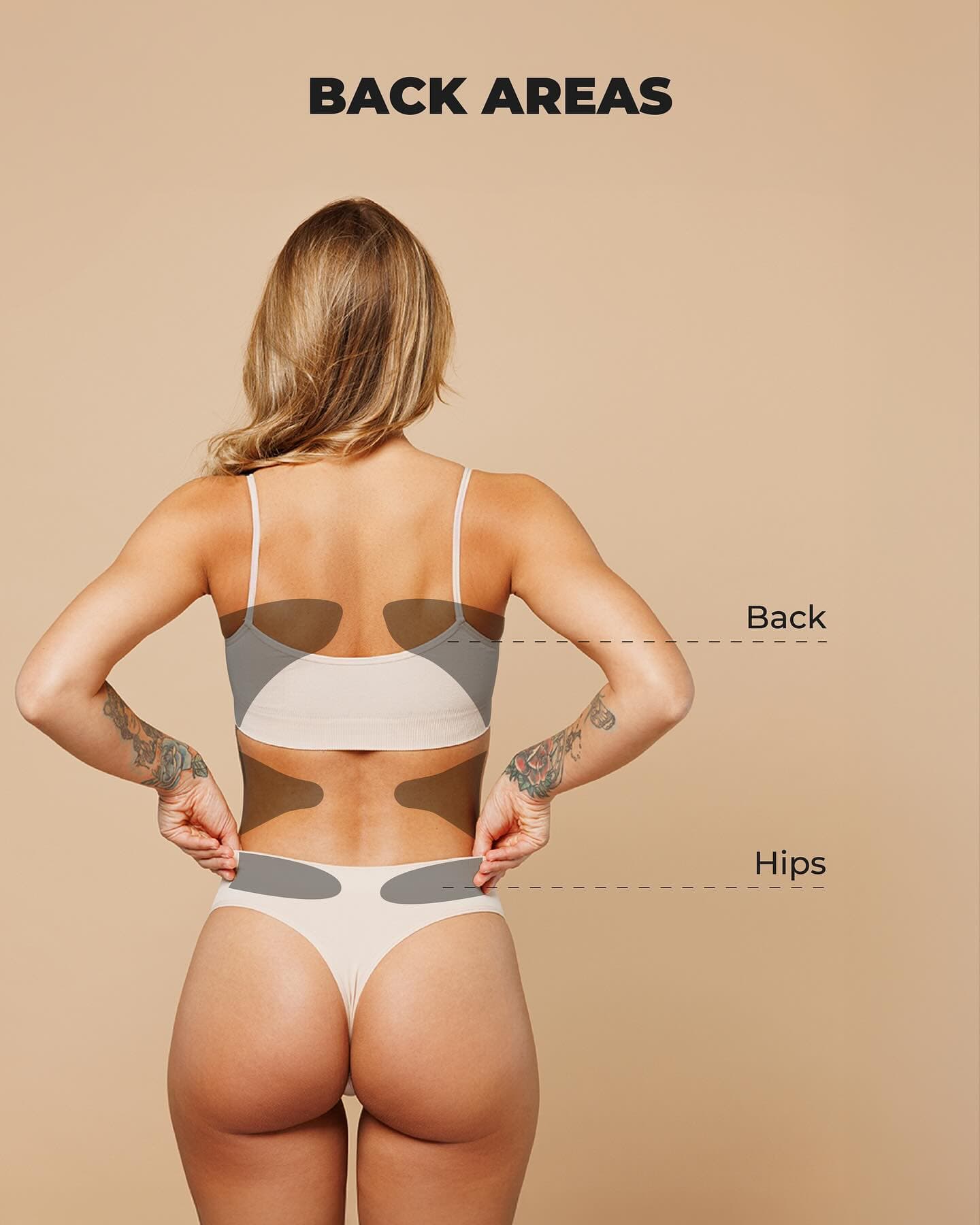 Educational image of a woman’s back and hips, with shaded overlays indicating common target zones for liposuction and body contouring procedures