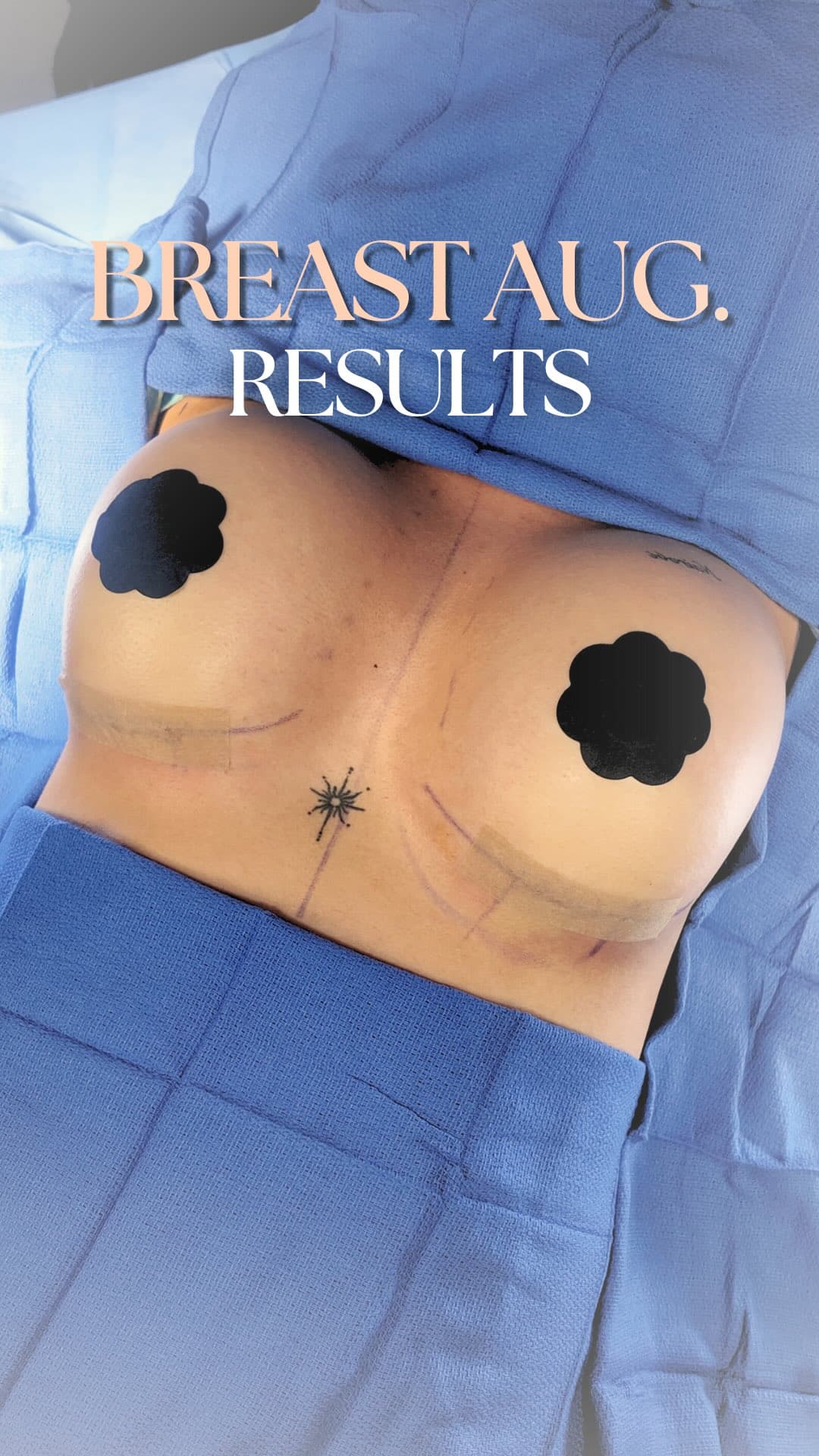 The most important thing when getting surgery for the first time?

✅ Safety
✅ Honest guidance
✅ A te