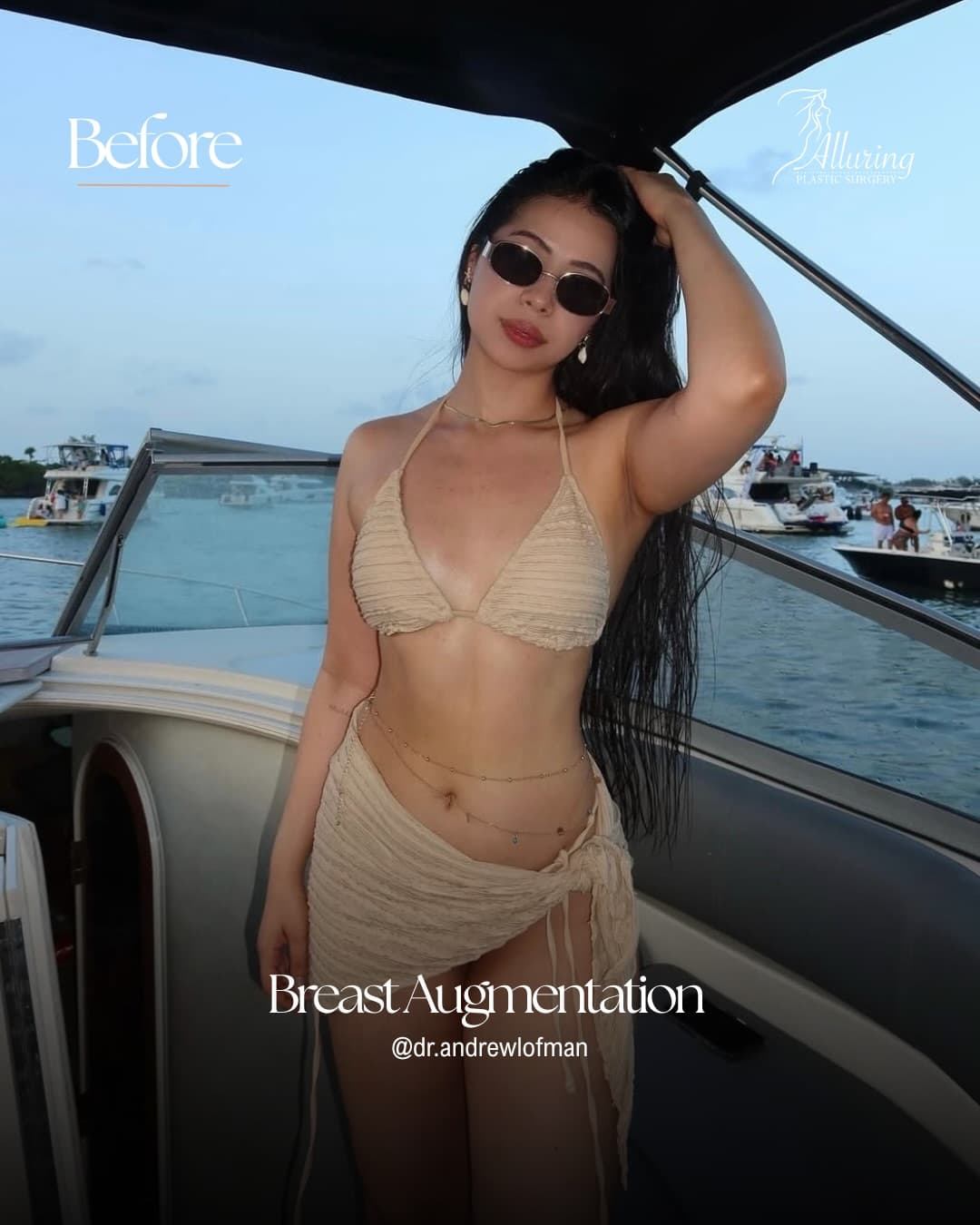 Instagram carousel item from alluringplasticsurgery