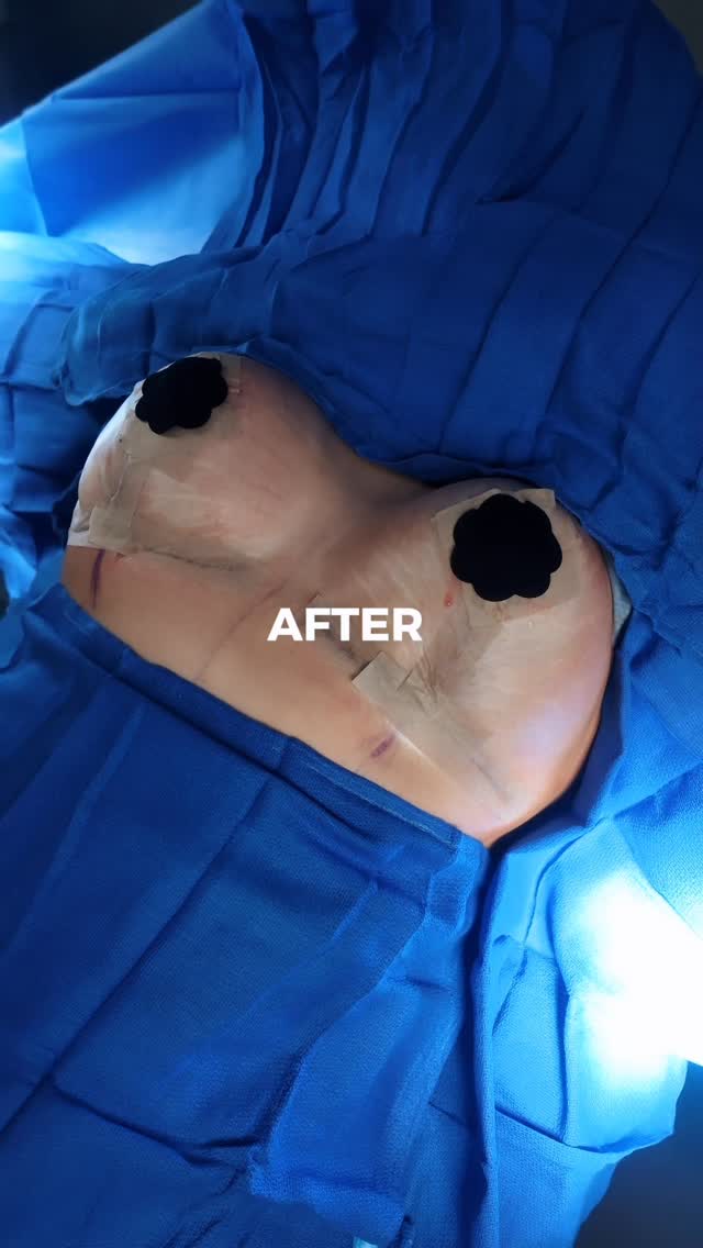 Your dream surgery is closer than you think. 🤍
With flexible payment options and financing availabl