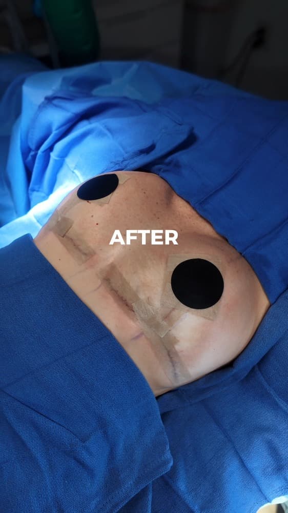 A breast reduction can be a transformative experience. This procedure alleviates physical discomfort