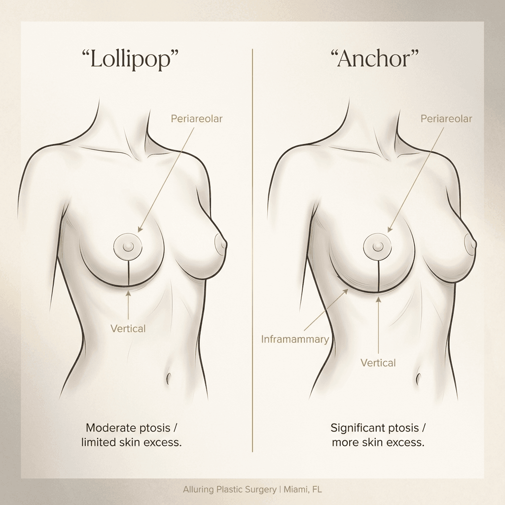 Side-by-side line illustration of breast with incision patterns labeled “Lollipop” vs “Anchor,” with a short caption noting typical indications (moderate vs significant ptosis/skin excess).