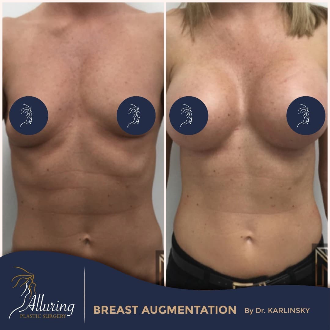 Instagram post from alluringplasticsurgery