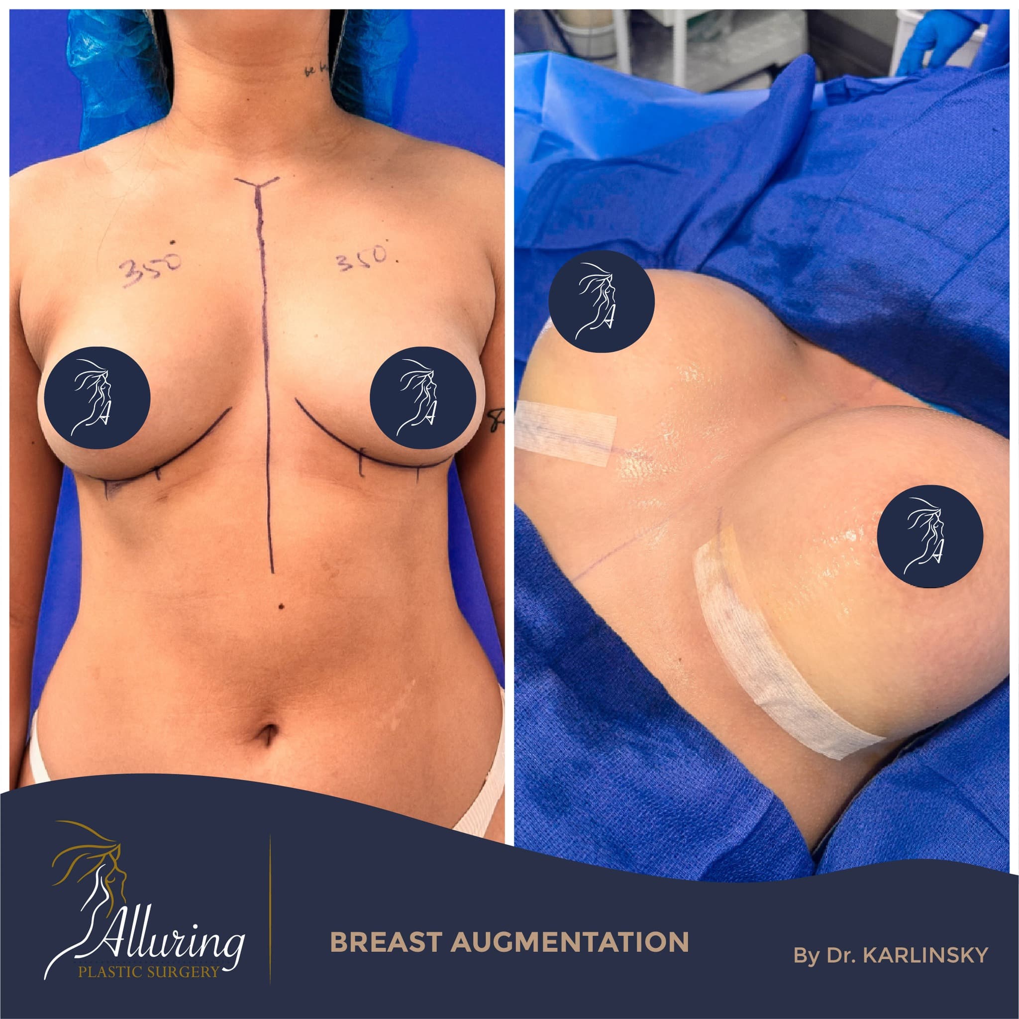 Instagram post from alluringplasticsurgery