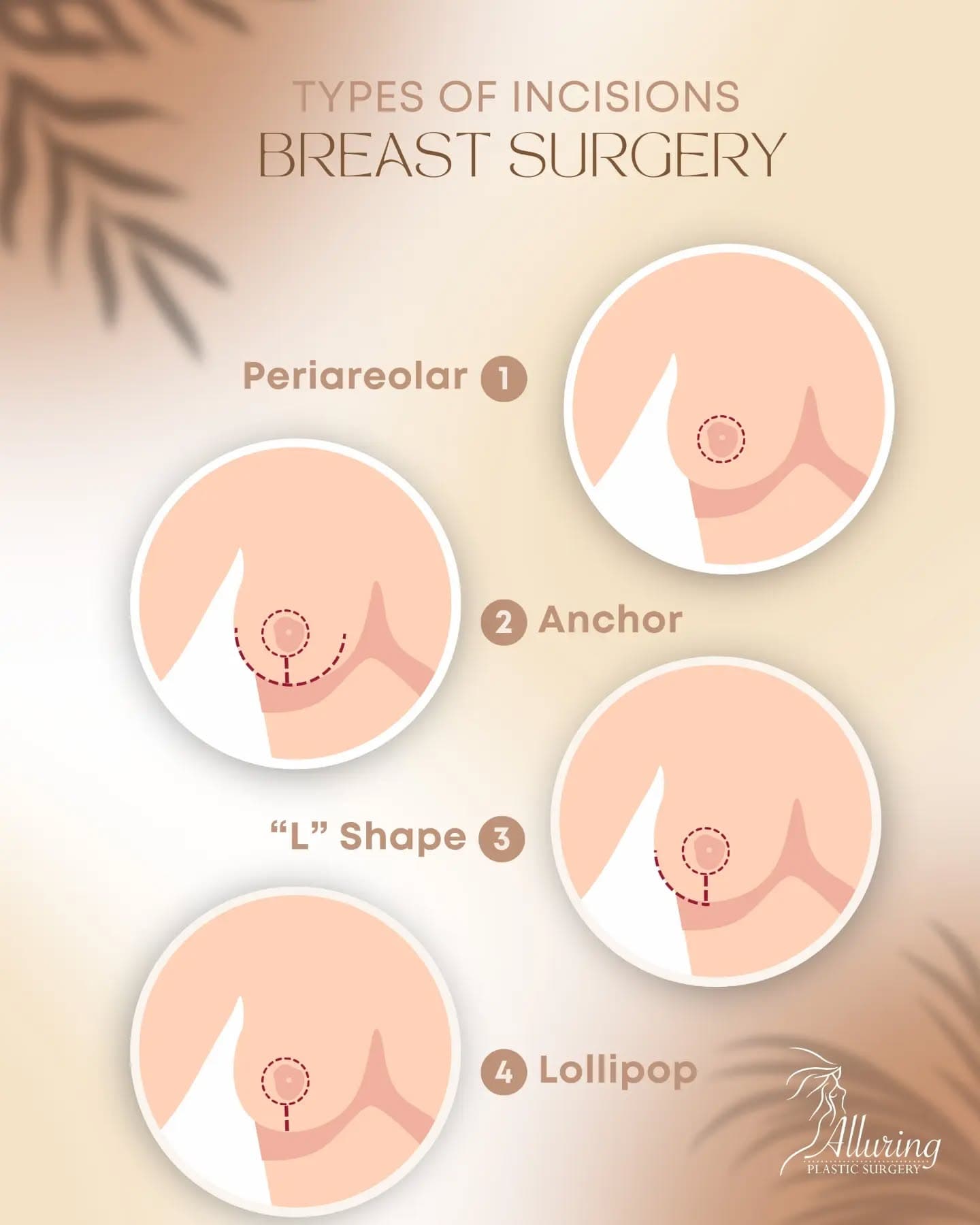Learn the types of incisions for breast procedures. 💫🌸
They are designed for your comfort and more