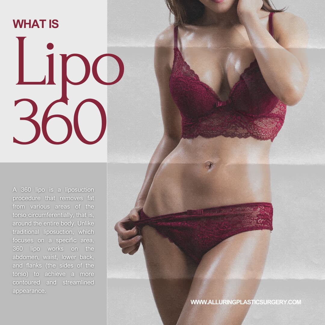 🌟 What is Lipo 360? 🌟
Lipo 360 is a comprehensive liposuction procedure that targets the entire m