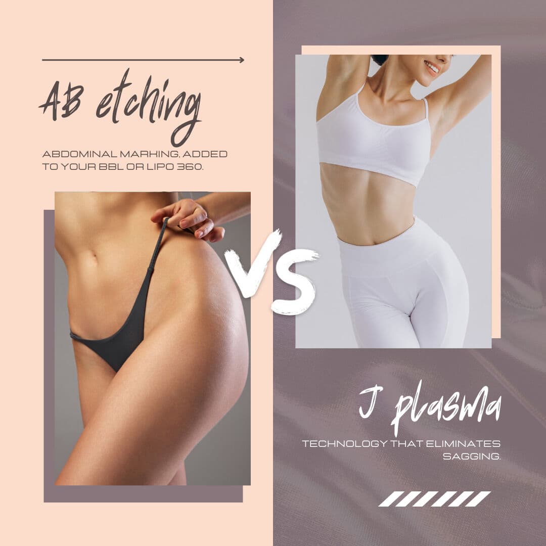 💡 Lipo HD vs. Renuvion J-Plasma: ¿Cuál es la diferencia? 💡
🔹 Lipo HD (Alta Definición) es una li