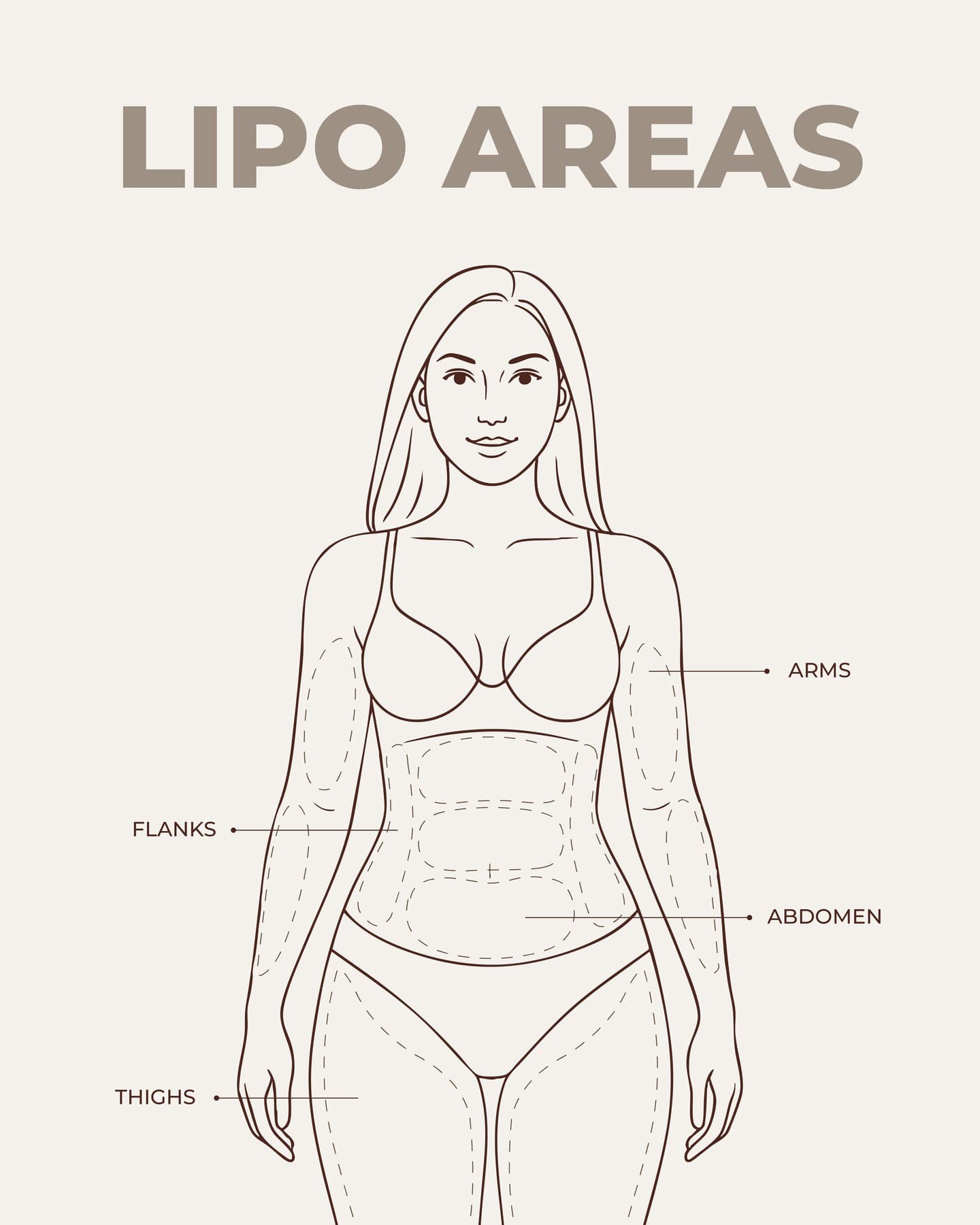 Educational diagram illustrating common liposuction areas on a woman's body, including arms, flanks, abdomen, and thighs, with each region clearly labeled