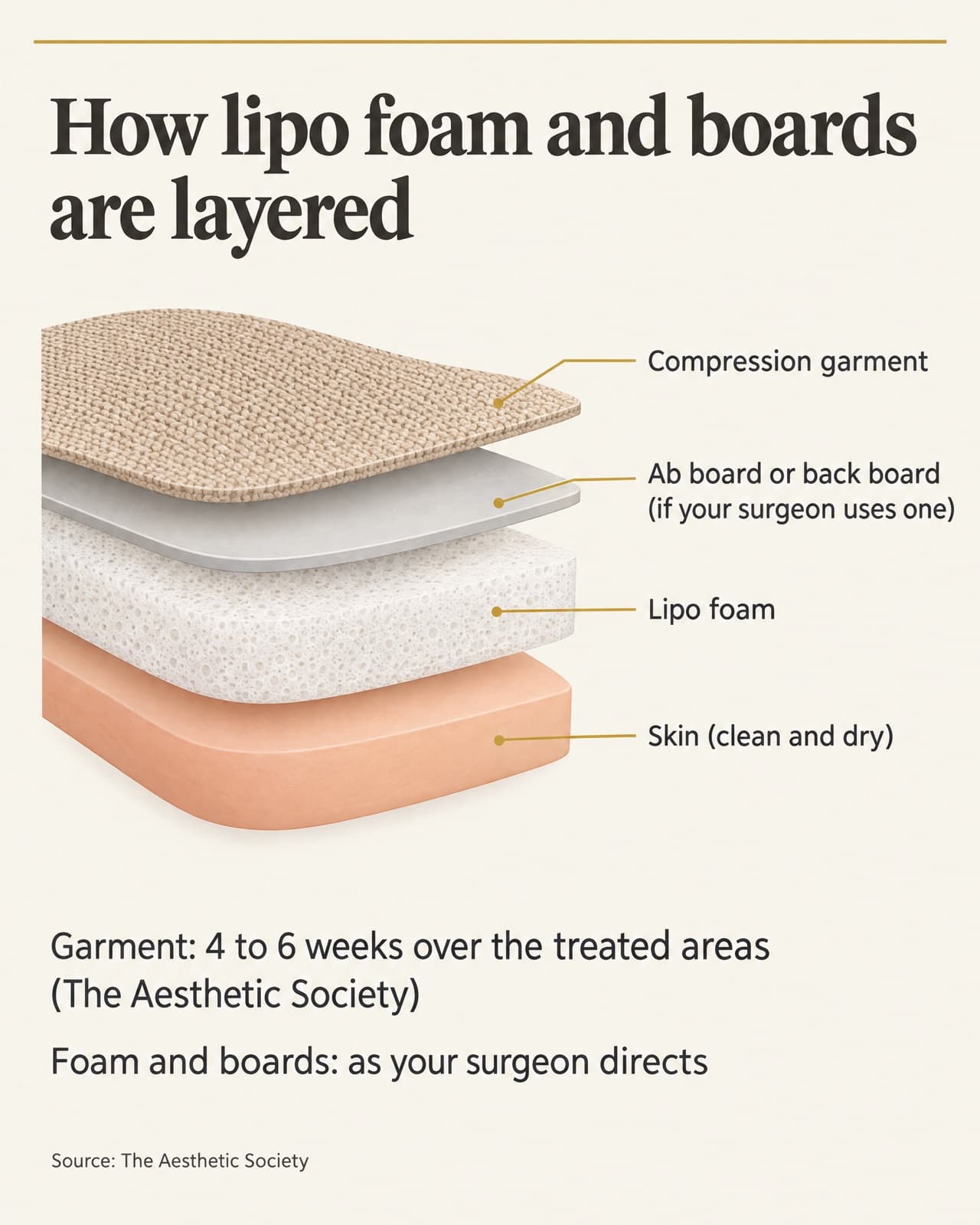 Layering diagram of lipo foam and boards: clean, dry skin, then lipo foam, then an ab board or back board if your surgeon uses one, then the compression garment. The garment is worn 4 to 6 weeks over the treated areas, according to The Aesthetic Society; foam and boards as your surgeon directs.